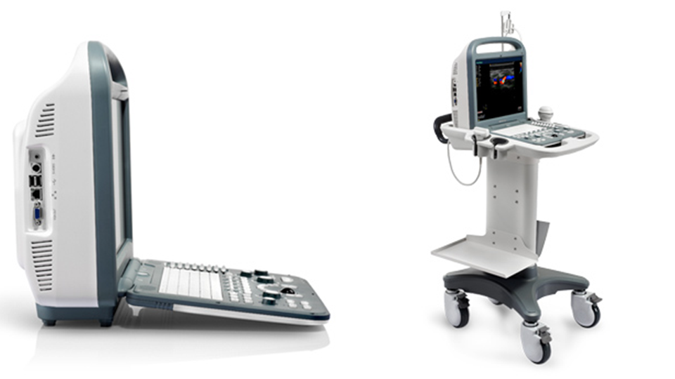UltraSound ColorDoppler S2